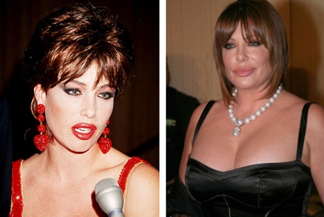 [Image: kelly-lebrock-plastic-surgery-before-and-after.jpg]