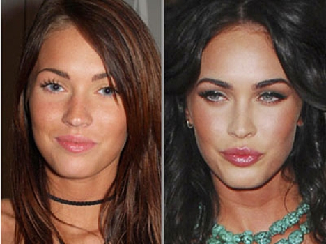 megan fox plastic surgery 2011 before and after. Megan Fox Plastic Surgery